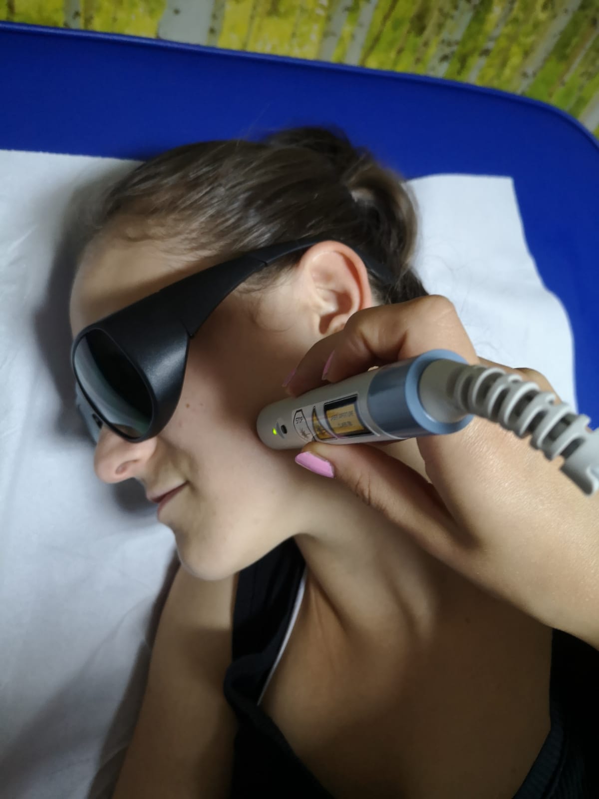 Fizioterapie (laser) ATM